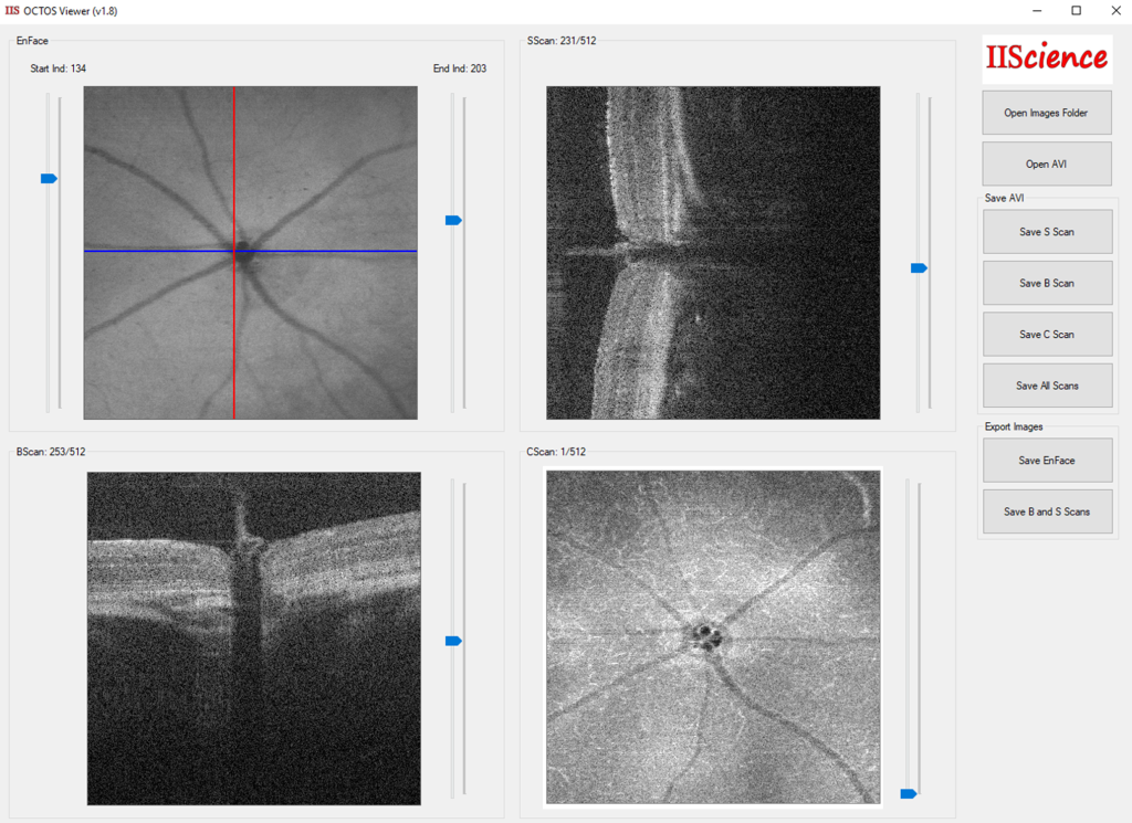 Octos Eye Scanner IISCIENCE