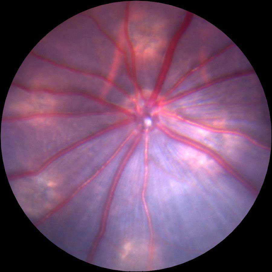 Rat retina image