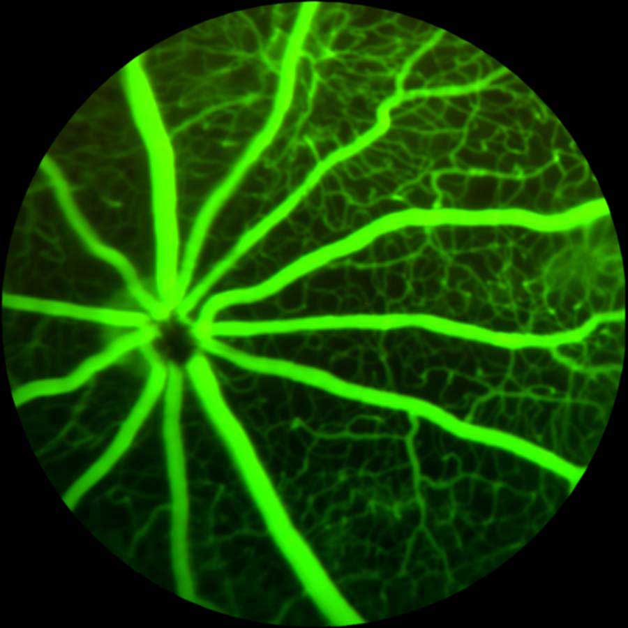 Fluorescein Angiography Image